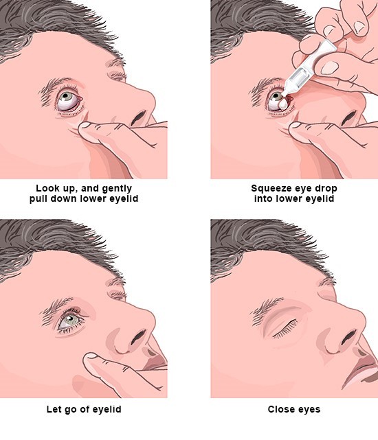 augentropfen enjpg replacement image rolf.