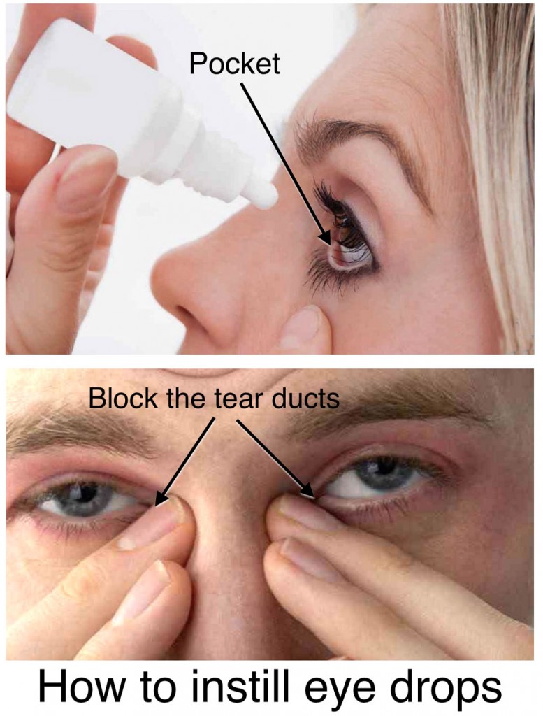 how to useeye drops 777x1024 1 rolf.